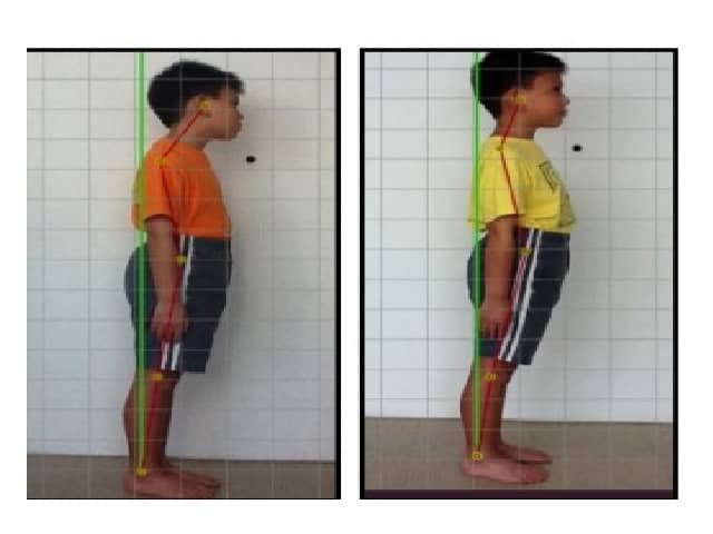 Child Posture Correction - Lifesystems Chiropractic